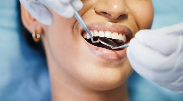 Best Holiday Emergency Dentist in Montpelier, IN